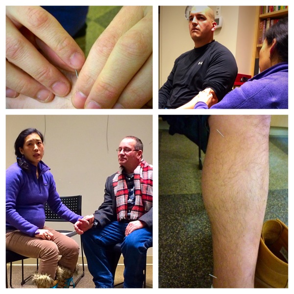 Health and Wellness Week: Acupuncture with High Peak Acupuncture
